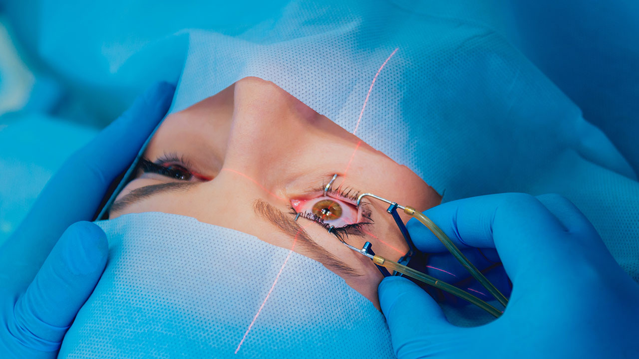 2.2 Mm Phaco Surgery